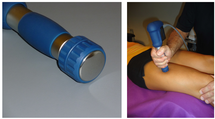 activation musculaire par ODCR
