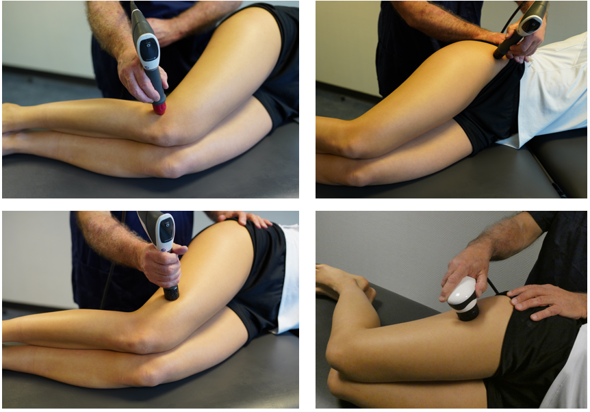 traitement par ondes de choc radiales et massage du TFL