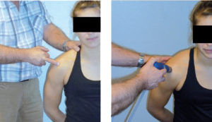Recherche palpatoire de l'insertion du supra épineux. Fig 9d : Application ODCR sur le supra épineux.