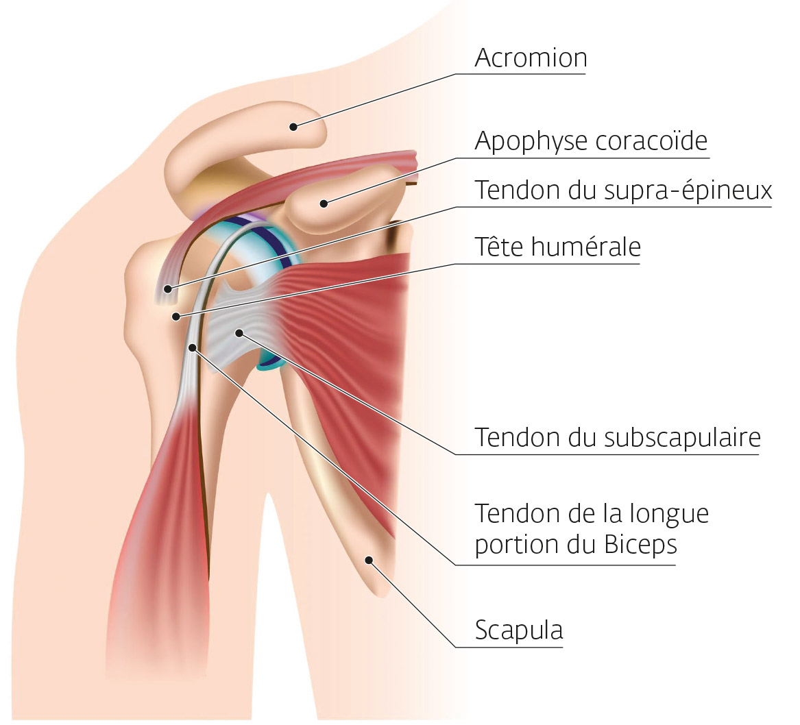 Formation kiné : tendinopathie épaule par électrothérapie 