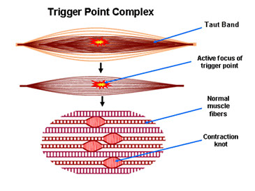fig 1. Points Trigger