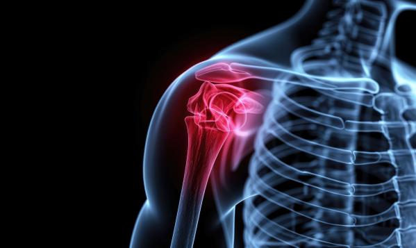 Treatment Strategies for Shoulder Pain