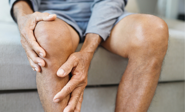 Physical Therapy Treatment for Knee Osteoarthritis: Evidence‑Informed Strategies for Clinicians