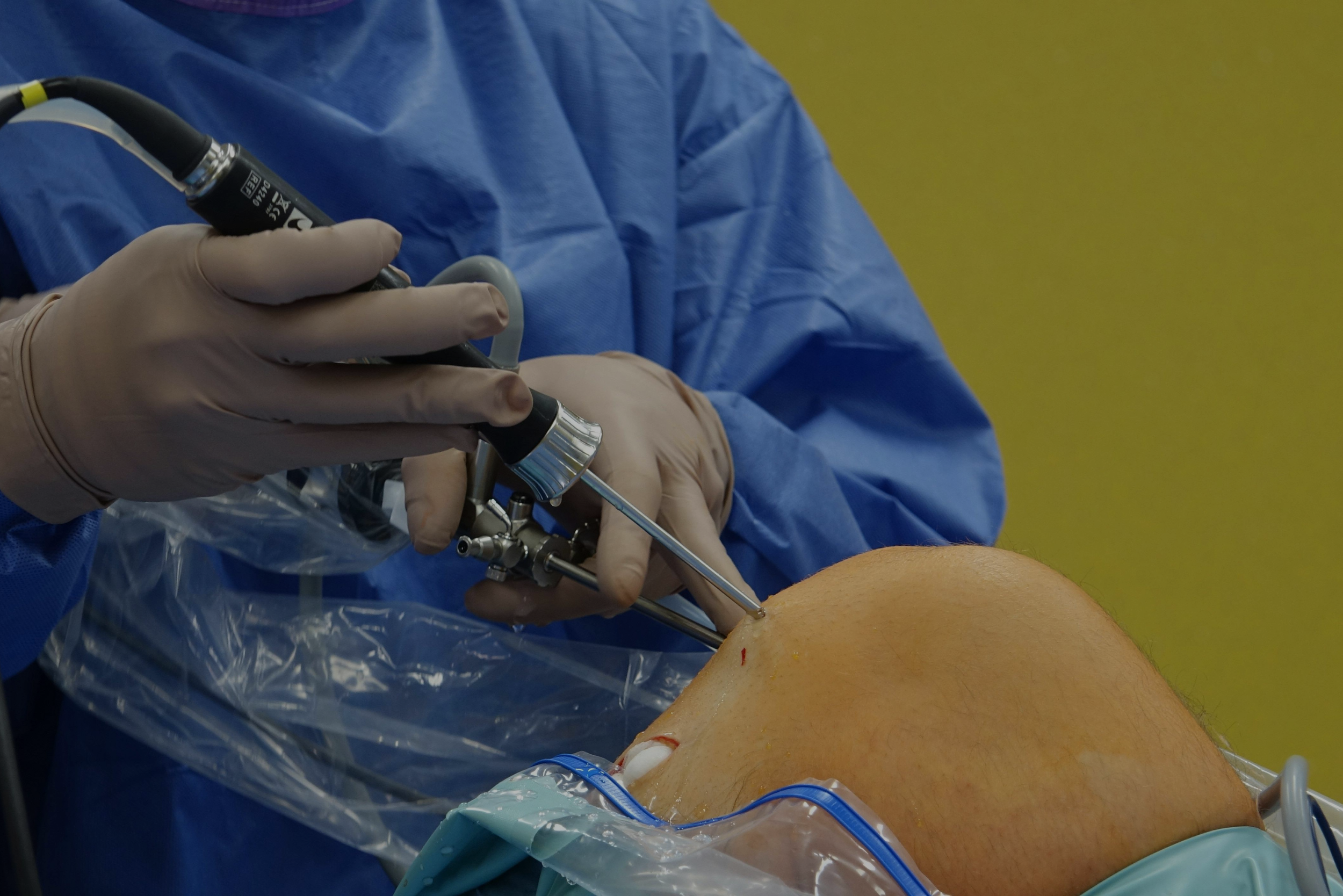 surgeon operating on ACL