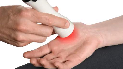 laser treatment for hand